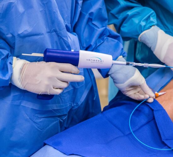 VenaSeal™ Glue Therapy