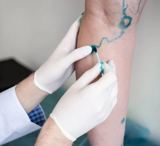 Doppler Ultrasound Mapping