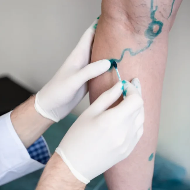 Doppler Ultrasound Mapping